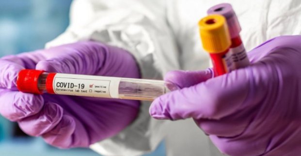  �������� 206 ������� ����������� covid-19 