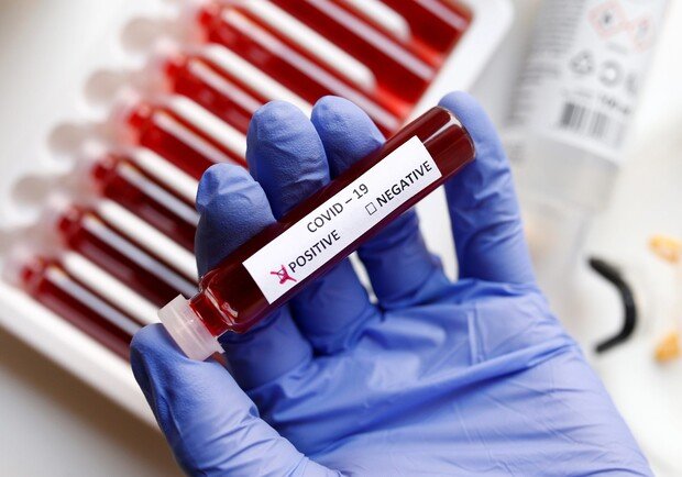  ���������� �������� ����� ������������� �ovid-19 