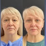 Роботи пластичного хірурга Абдель Еріталі
