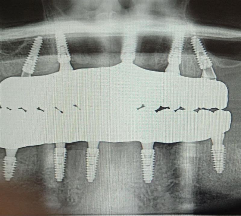Республіканський центр стоматологічної імплантації