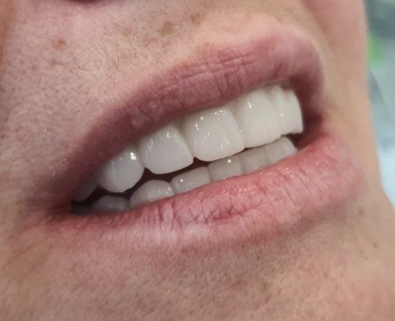 Республіканський центр стоматологічної імплантації (РЦСД)