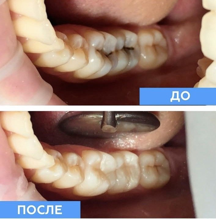 Республіканський центр стоматологічної імплантації