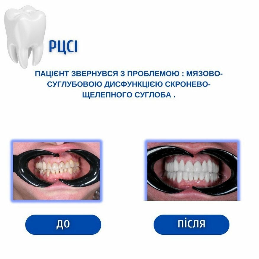 Республіканський центр стоматологічної імплантації
