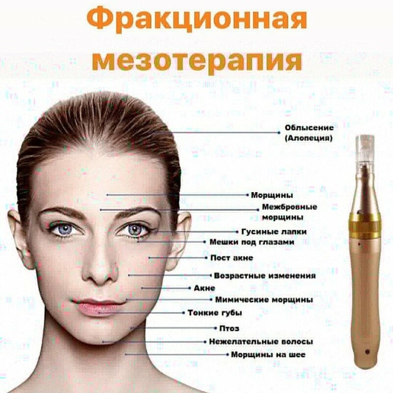 Мезотерапия и Биоревитализация Дермоштамп - Зображення 8