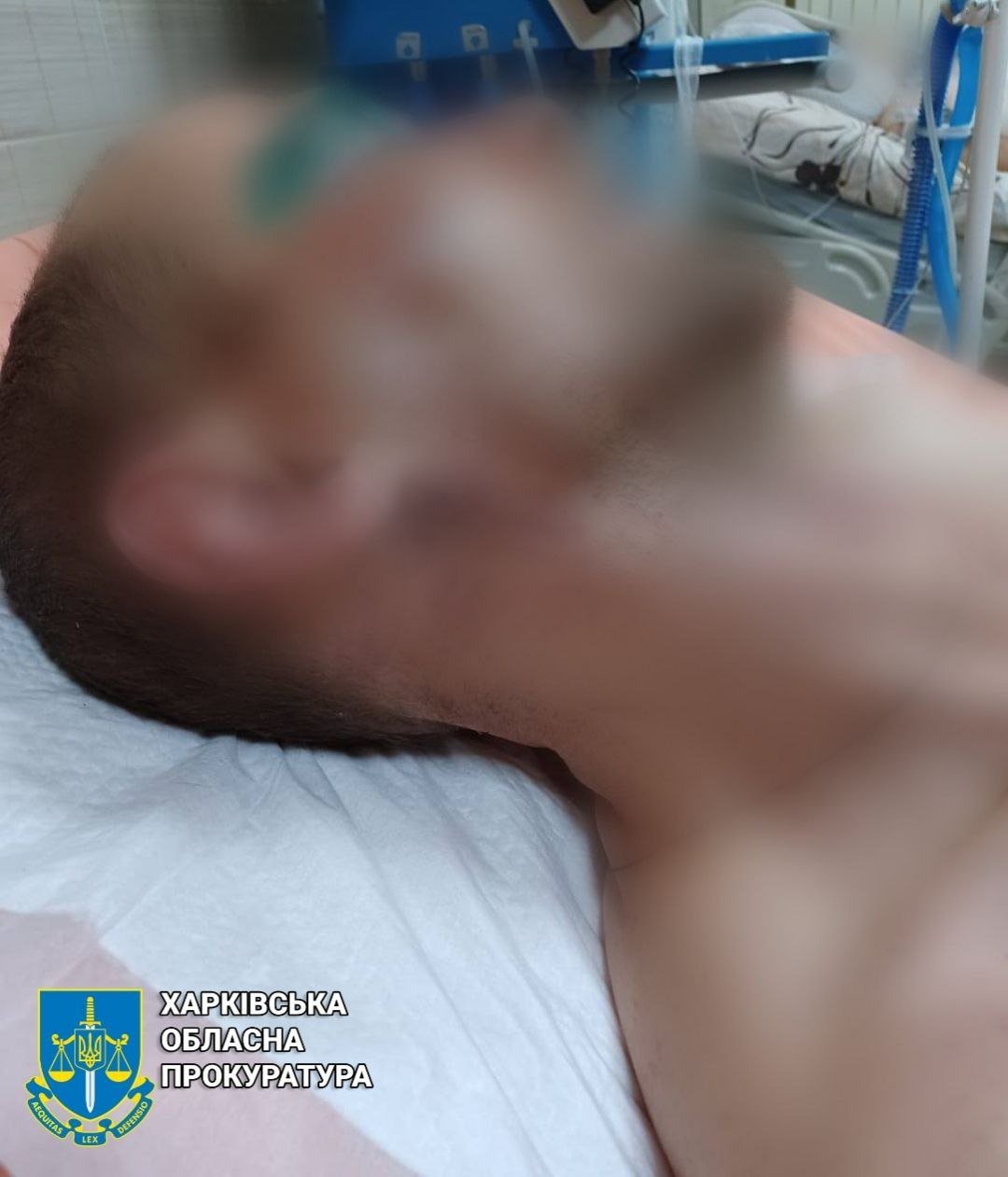 На Харківщині чоловік ніжкою з кухонного стільця жорстоко побив знайомого: він помер у лікарні, - ФОТО